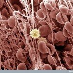 Human Body Microscopic Picture - Blood Clot with White Blood Cell