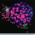 Human Body Microscopic Picture - Human Embryo Surrounded by Sperm