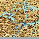 Human Body Microscopic Picture - Sperm Trying to Fertilize a Human Egg