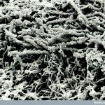 Human Body Microscopic Picture - Tooth Plaque